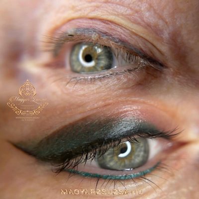 RainbowEyes (fibroma eltávolítás után)